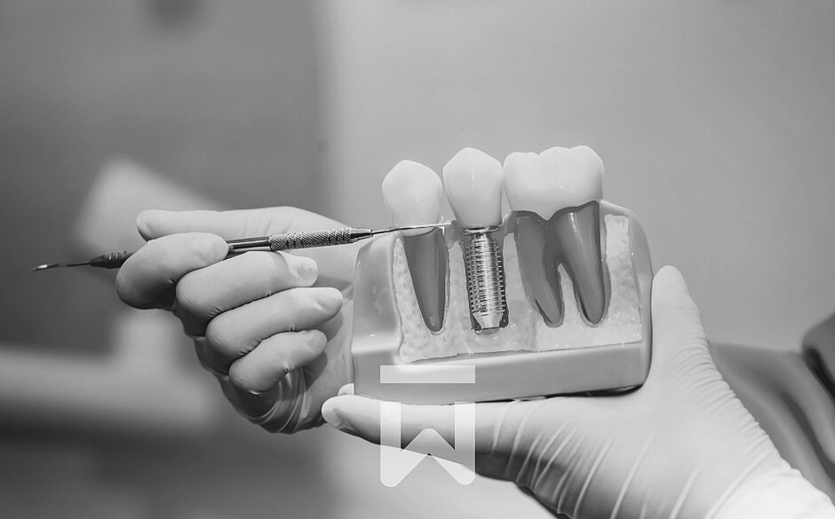 Zahnärztin Olowookere erklärt eine Implantat anhand eines Modells
